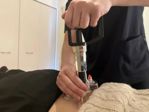 鍼灸マッサージ＆カッピングコース